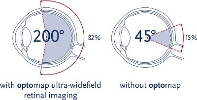 Our latest Eyecare Technology