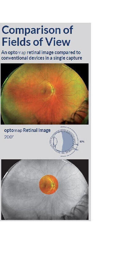 Specialist Equipment