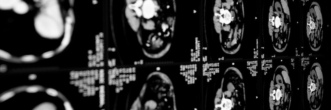 Arterial Disease - Image 2