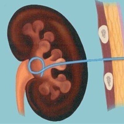 General Image Guided Intervention - Image 1