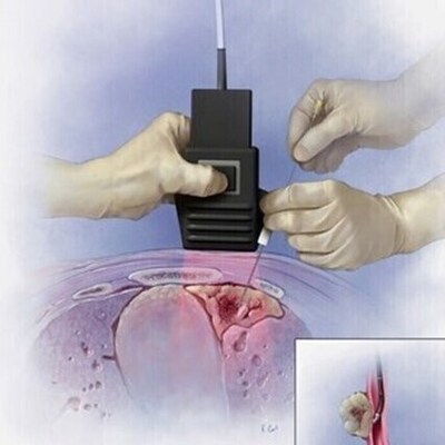 General Image Guided Intervention - Image 2