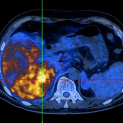 General Image Guided Intervention - Image 3