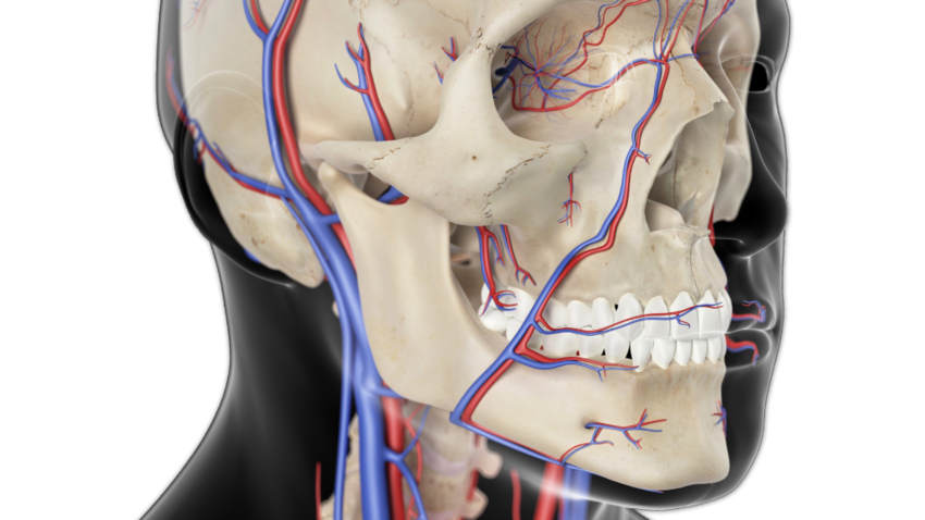 Carotid artery disease