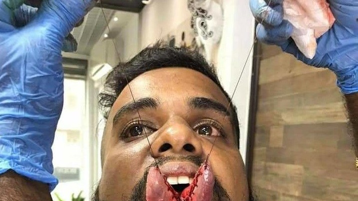 ஸ்ரைல் மோகத்தில் நாக்கை இரண்டாகப் பிளந்த இளைஞர்