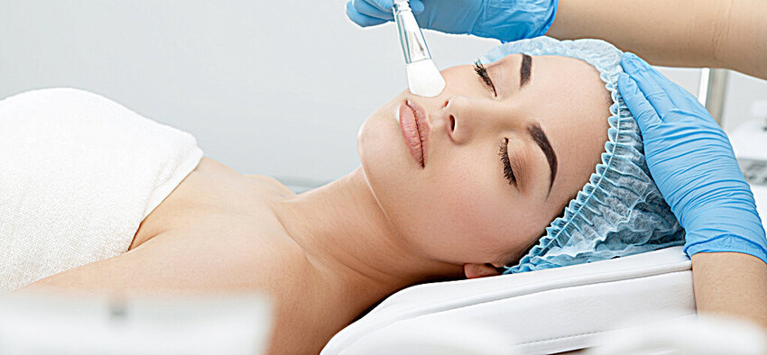 Chemical Peel
