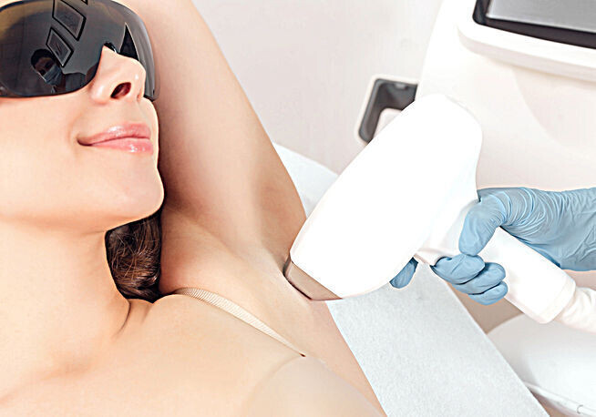 Hair Removal IPL