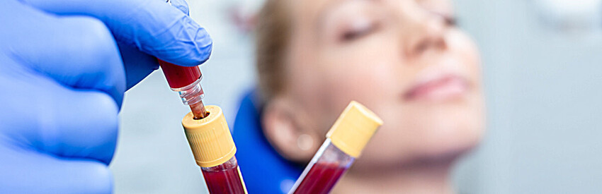 Vampire Lift Platelet  Rich Therapy