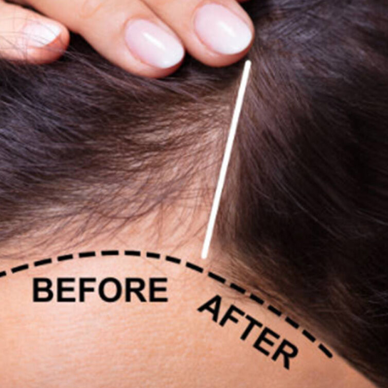 Hairline, Roots & Scalp Oil