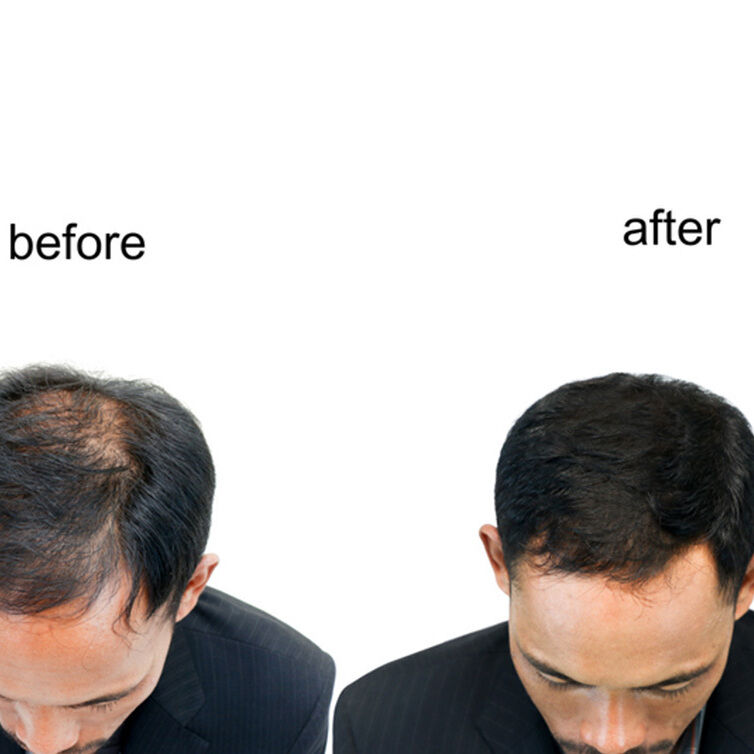 Hairline, Roots & Scalp Oil