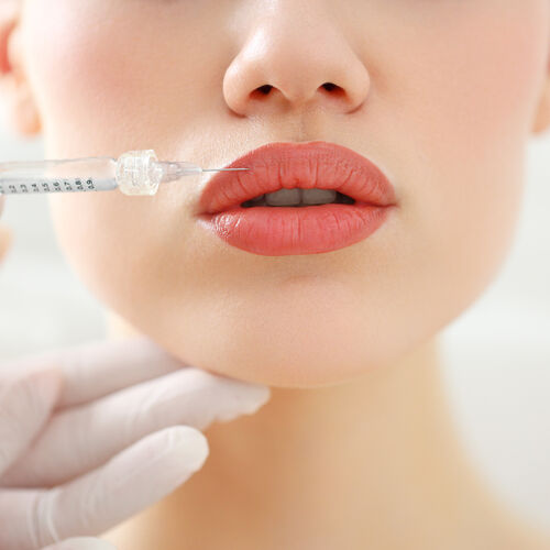 Dermal Fillers