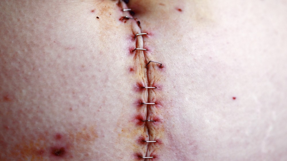 கத்தி வெட்டில் இளைஞர் படுகாயம்