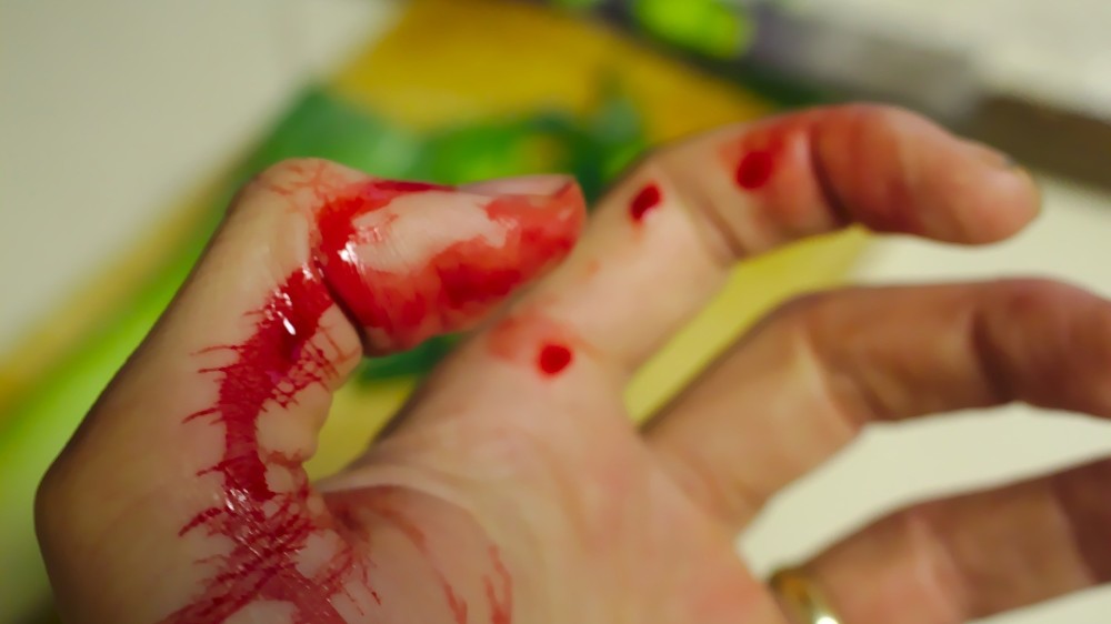 உரும்பிராய் சந்தியில் இடம்பெறும் விபத்துகள்