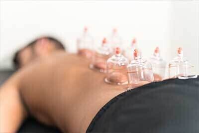 Cupping Therapy