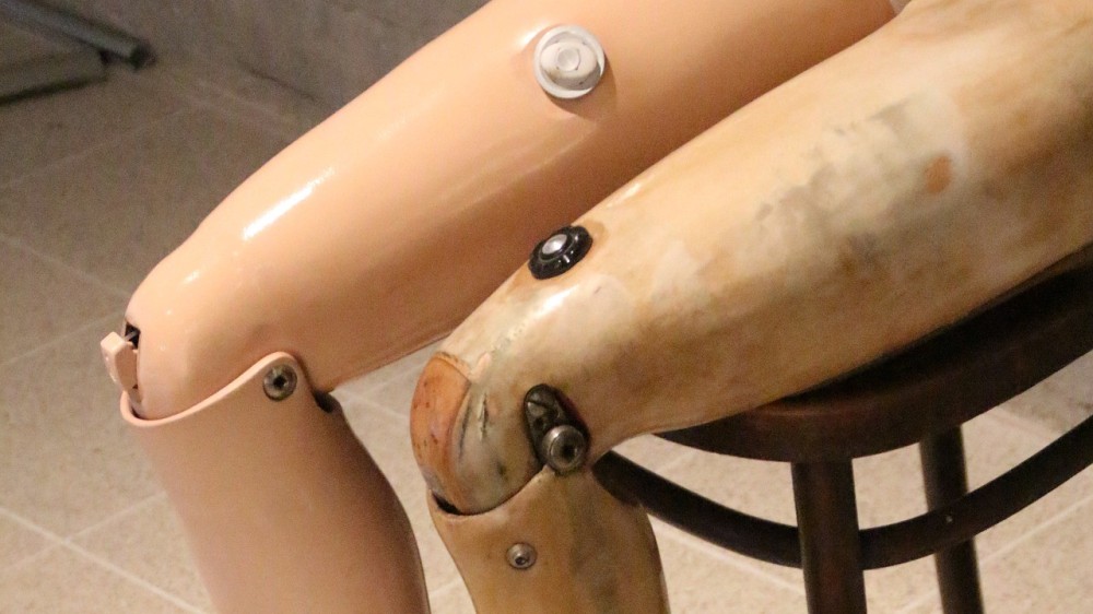 ஜெய்பூர் செயற்கை கால் பொருத்தும் முகாம்