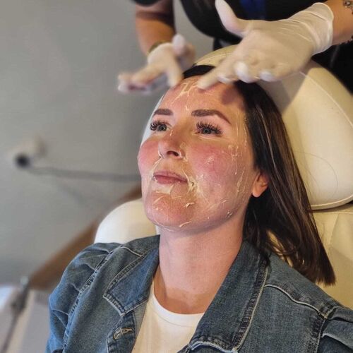 Full Face Harmonisation