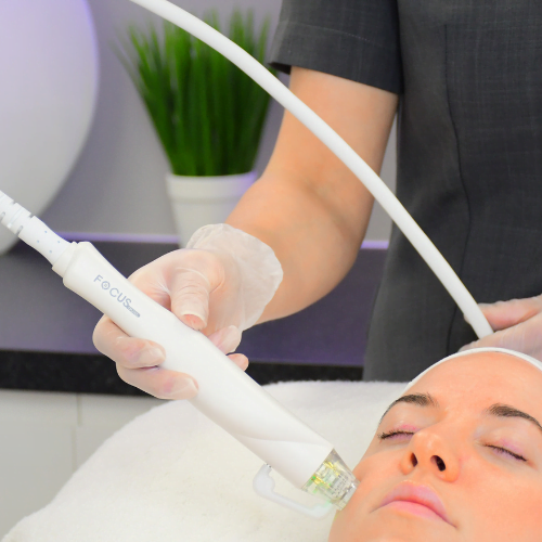 Full Face Harmonisation