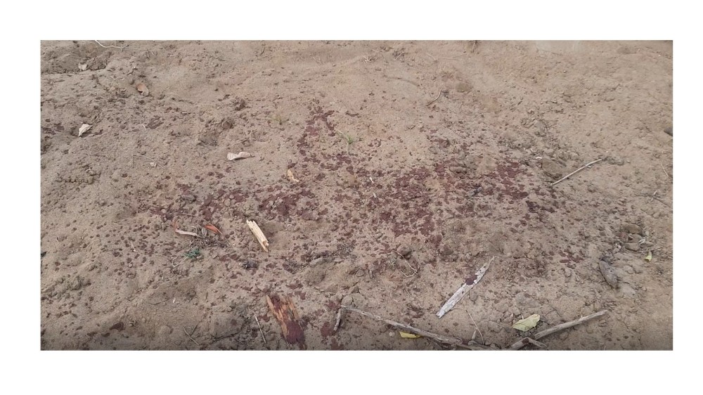 கண்ணிவெடி வெடித்ததால் கை சிதறியது