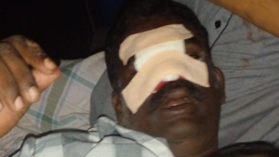 கடற்படையினரால்  கொடூரமாகத் தாக்கப்பட்ட குடும்பத்தர்