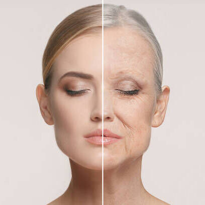Anti Wrinkle Injections