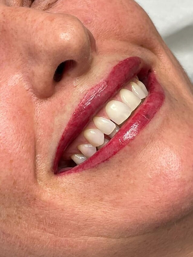 Semi-Permanent Lips Master Training