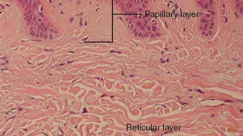 Aging begins in the epidermis.
