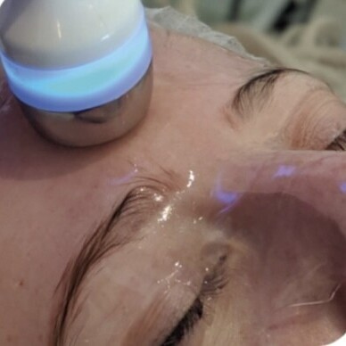 HYDRO FACIAL