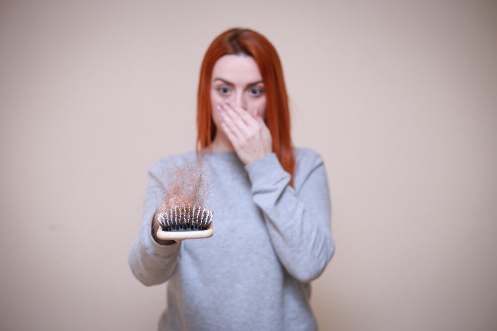 Girl holding brush with lots of lost hairs depicting hair loss