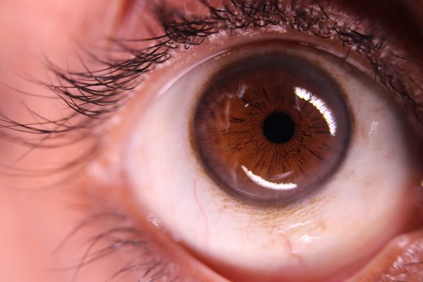 What is Iridology?