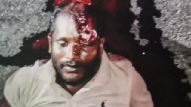 மன்னாரில் படுகாயமடைந்தவர் மீட்பு