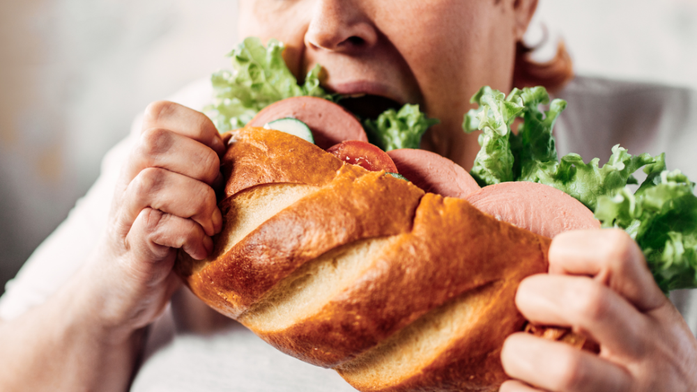 Overnutrition, a Form of Malnutrition: Causes, Consequences, and Impact on Immunity