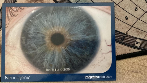 Neurogenic Structure type