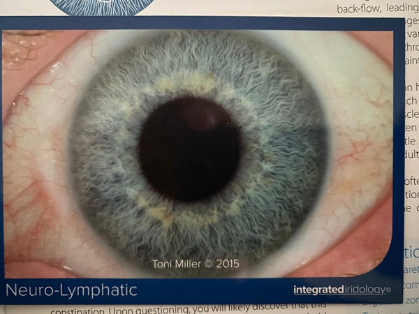 Neuro-Lymphatic Structure 