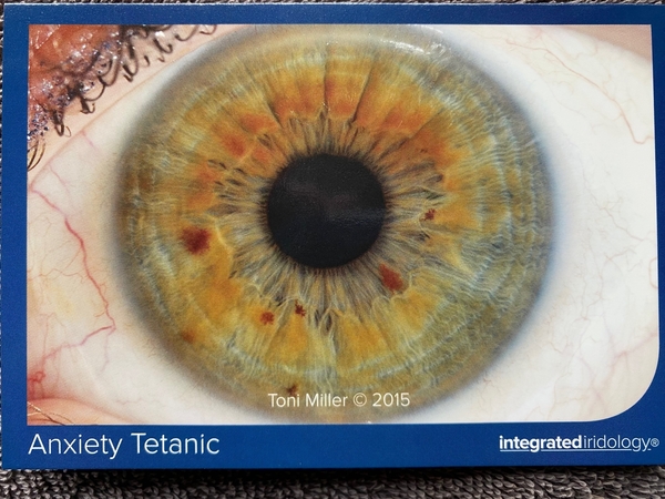 Anxiety Tetanic Constitution