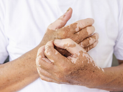 Medical Micropigmentation