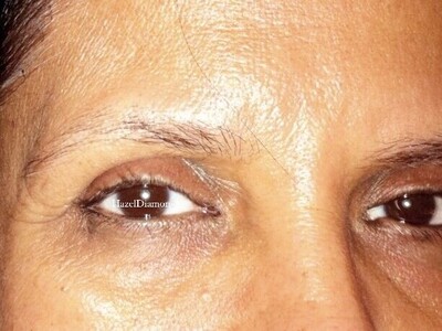 Removal & Correction Work