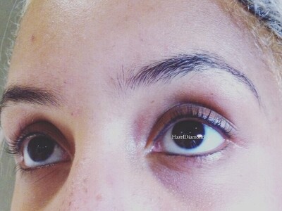 Removal & Correction Work