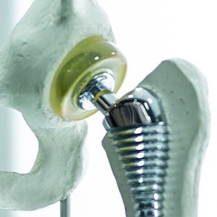 European Medical Device Compliance Assured: An Optimal Solution for Safe and Effective Cleaning Fluids