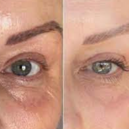 What is Beautyfeye®?