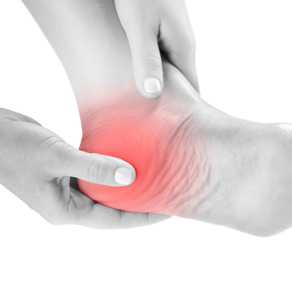 Plantar fasciitis