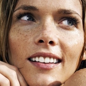 *Hyperpigmentation Facts*