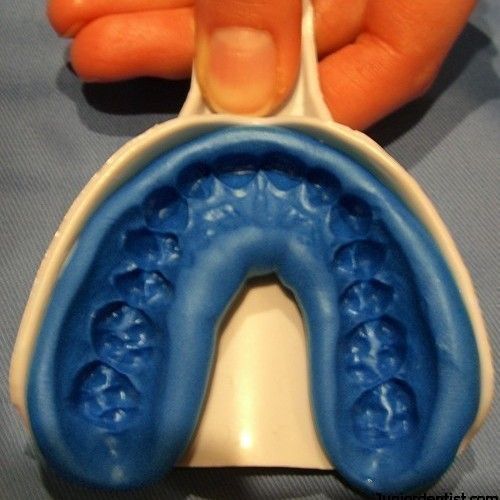 Home whitening - £275 