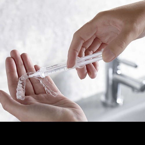 Home whitening - £275 