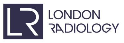 London Radiology | CT Colonoscopy London | London Radiology | London Radiologist