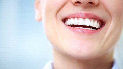 Tooth Whitening