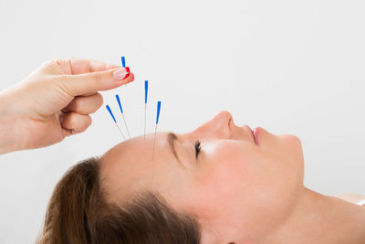 Medical Acupuncture