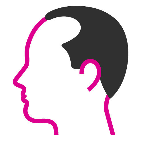 Scalp Micropigmentation Cardiff, Hair Tattoo Cardiff, Hair Loss Treatment Cardiff