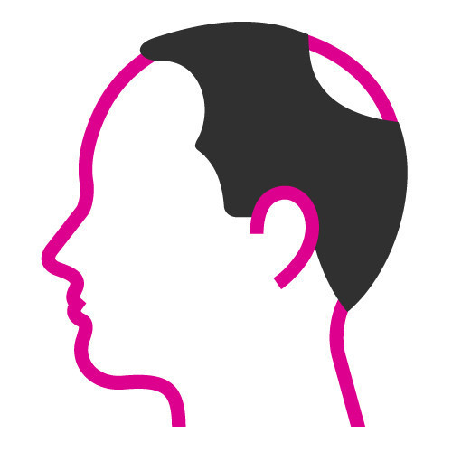 Scalp Micropigmentation Cardiff, Hair Tattoo Cardiff, Hair Loss Treatment Cardiff