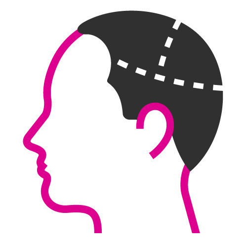 Scalp Micropigmentation Cardiff, Hair Tattoo Cardiff, Hair Loss Treatment Cardiff