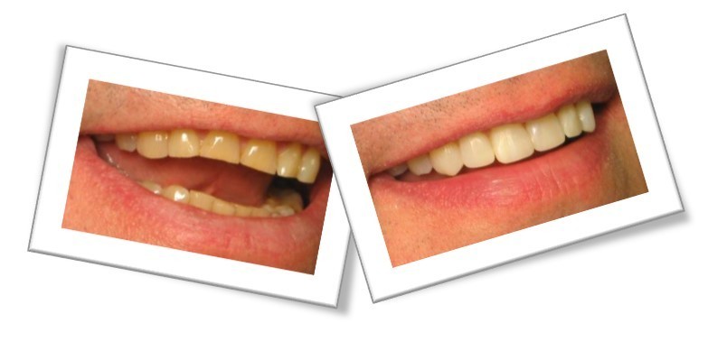 Cosmetic Dentistry
