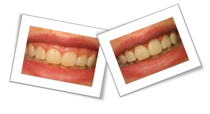 Cosmetic Dentistry
